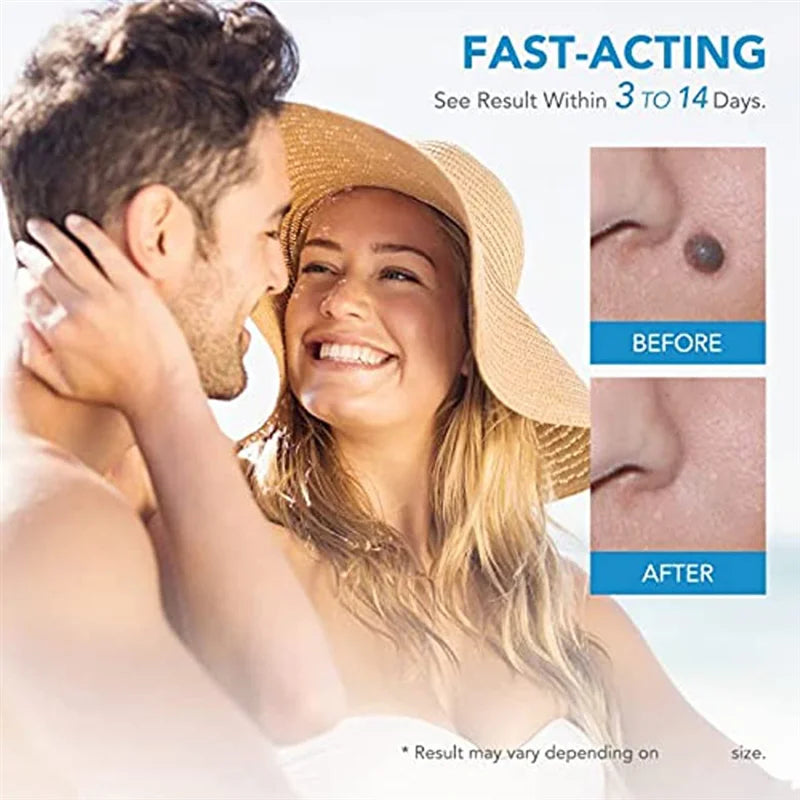 2 In1 Painless Auto Skin Tag Mole Wart Removal Kit Skin Care Body Wart Dot Treatments Remover Cleaning Tools