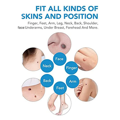2 In1 Painless Auto Skin Tag Mole Wart Removal Kit Skin Care Body Wart Dot Treatments Remover Cleaning Tools